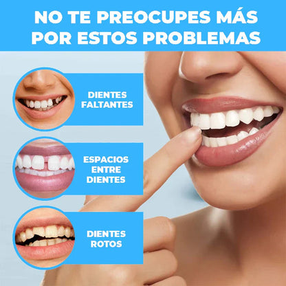 Carillas Dentales Removibles SonriFit™ Superior e Inferior [COMPRA 1 Y LLÉVATE 2]