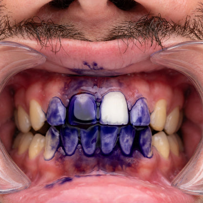 VioletSmile™ Pasta Dental Morada V34 Correctora de Color –