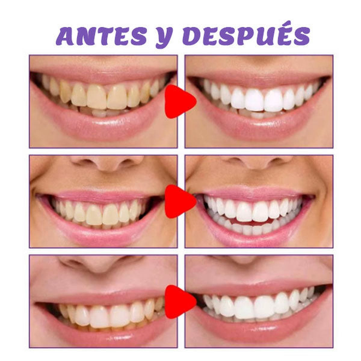 VioletSmile™ Pasta Dental Morada V34 Correctora de Color –